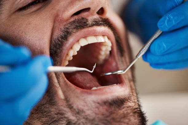 Best Emergency Treatment for Dental Infections or Abscesses in Metamora, IL