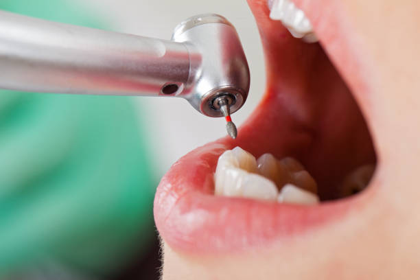 Best Cosmetic Emergency Dentistry in Metamora, IL